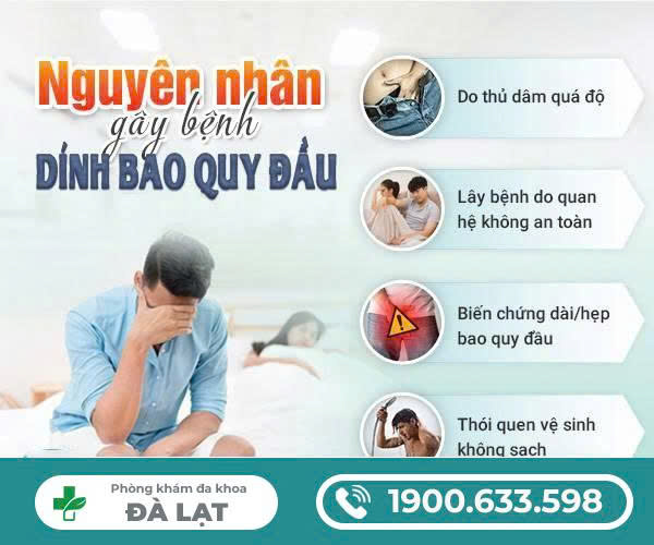 Hình ảnh minh họa